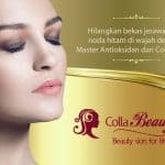 Mau Menikah? Lakukan Perawatan Ini Dulu yaaa, Colla Beauty Josss